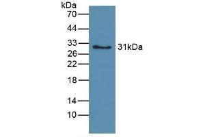 Detection of Recombinant hemoglobin, Canine using Polyclonal Antibody to Hemoglobin (HB) (Hemoglobin 抗体)