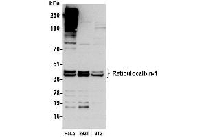 anti-Reticulocalbin 1, EF-Hand Calcium Binding Domain (RCN1) (AA 1-75) antibody