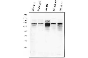Western blot analysis of KAT13A/SRC1 using anti-KAT13A/SRC1 antibody (ABIN3042385).