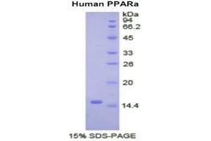 SDS-PAGE analysis of Human PPARA Protein. (PPARA 蛋白)