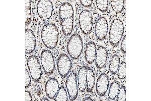 IHC analysis of SNRNP40 using anti-SNRNP40 antibody (ABIN7601719). (SNRNP40 抗体  (AA 43-357))