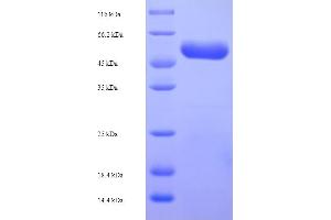 SDS-PAGE (SDS) image for Cfa/I Fimbrial Subunit E (Colonization Factor Antigen I Subunit E, Pilin Subunit) (CFAE) (AA 1-360), (full length) protein (His-SUMO Tag) (ABIN5710858) (cfaE Protein (AA 1-360, full length) (His-SUMO Tag))