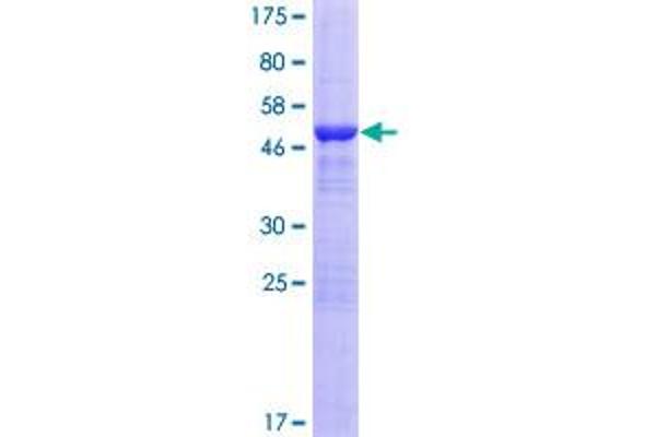 KCTD6 Protein (AA 1-237) (GST tag)