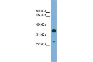 WB Suggested Anti-TPD52 Antibody Titration:  0. (TPD52 抗体  (C-Term))