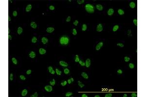 Immunofluorescence of monoclonal antibody to MLH1 on HeLa cell. (MLH1 抗体  (AA 1-756))