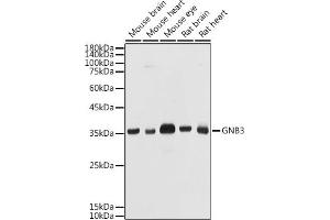 Western blot analysis of extracts of various cell lines, using GNB3 antibody (ABIN1680055, ABIN3015467, ABIN3015468 and ABIN6218020) at 1:1000 dilution. (GNB3 抗体  (AA 1-230))