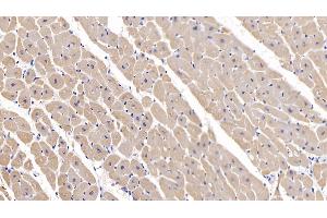 Immunohistochemistry (IHC) image for anti-Myosin Heavy Chain 2, Skeletal Muscle, Adult (MYH2) (AA 1237-1471) antibody (ABIN7440437)