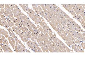 Detection of MYH2 in Human Cardiac Muscle Tissue using Polyclonal Antibody to Myosin Heavy Chain 2 (MYH2) (MYH2 抗体  (AA 1237-1471))