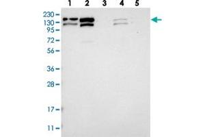 Western blot analysis of Lane 1: RT-4, Lane 2: U-251 MG, Lane 3: Human Plasma, Lane 4: Liver, Lane 5: Tonsil with CCAR1 polyclonal antibody . (CCAR1 抗体)