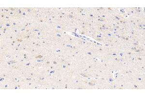 Detection of ACVR2A in Human Cerebrum Tissue using Monoclonal Antibody to Activin A Receptor Type II A (ACVR2A)