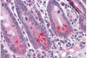 Human Small Intestine: Formalin-Fixed, Paraffin-Embedded (FFPE) (BIRC6 抗体  (C-Term))