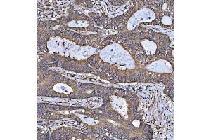 IHC analysis of HSD17B7 using anti-HSD17B7 antibody (ABIN7600174).