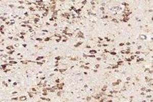 Immunohistochemistry analysis of paraffin-embedded mouse brain using,RPL10 (ABIN7075428) at dilution of 1: 4000 (RPL10 抗体)
