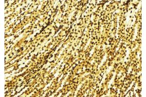 ABIN6269316 at 1/100 staining Human gastric tissue by IHC-P. (MEK1 抗体  (Internal Region))