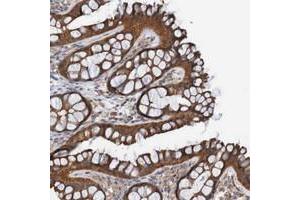 Immunohistochemical staining of human colon with ST8SIA6 polyclonal antibody  shows strong cytoplasmic positivity in glandular cells at 1:50-1:200 dilution. (ST8SIA6 抗体)