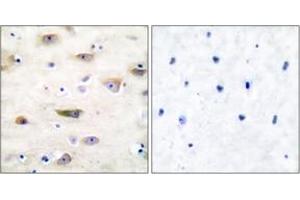 Immunohistochemistry analysis of paraffin-embedded human brain tissue, using GluR2 (Ab-880) Antibody. (GRIA2 抗体  (AA 834-883))