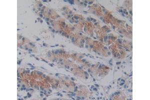 Used in DAB staining on fromalin fixed paraffin- embedded stomach tissue (Tensin 1 抗体  (AA 4-307))
