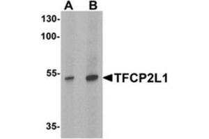 Western blot analysis of TFCP2L1 in human colon tissue lysate with TFCP2L1 antibody at (A) 1 and (B) 2 ug/mL (TFCP2L1 抗体  (N-Term))
