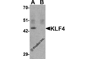 Western Blotting (WB) image for anti-Kruppel-Like Factor 4 (Gut) (KLF4) antibody (ABIN1031709) (KLF4 抗体)