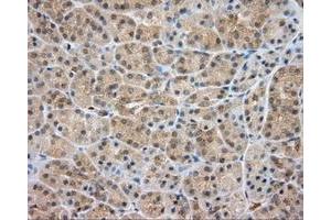 Immunohistochemical staining of paraffin-embedded liver tissue using anti-SRR mouse monoclonal antibody. (SRR 抗体)