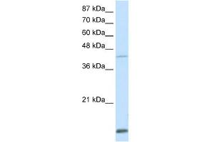 WB Suggested Anti-MKX Antibody Titration:  0. (MKX 抗体  (Middle Region))