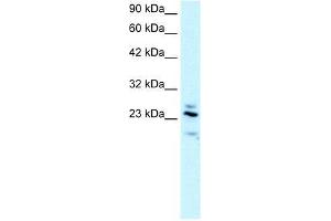 Human brain; WB Suggested Anti-RGS20 Antibody Titration: 2. (RGS20 抗体  (all Isoforms, Middle Region))
