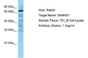 WB Suggested Anti-SAMHD1 Antibody Titration: 0. (SAMHD1 抗体  (Middle Region))