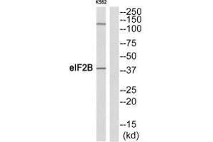 Western blot analysis of extracts from K562 cells, using eIF2B (Ab-67) antibody.