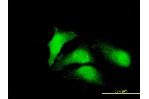 Immunofluorescence of purified MaxPab antibody to CDCA8 on HeLa cell. (CDCA8 抗体  (AA 1-280))