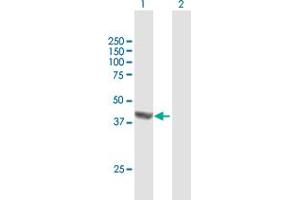 Western Blot analysis of DHPS expression in transfected 293T cell line by DHPS MaxPab polyclonal antibody. (DHPS 抗体  (AA 1-369))