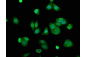 Immunofluorescence staining of HepG2 cells with ABIN7143477 at 1:100, counter-stained with DAPI. (ARL11 抗体  (AA 2-196))