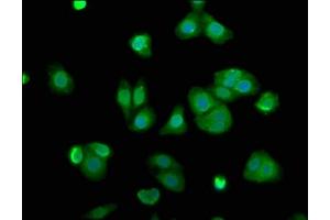 Immunofluorescence staining of HepG2 cells with ABIN7143477 at 1:100, counter-stained with DAPI. (ARL11 抗体  (AA 2-196))