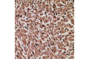 Immunohistochemical analysis of MYCBP staining in human heart formalin fixed paraffin embedded tissue section. (MYCBP 抗体)