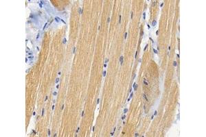Immunohistochemistry (Paraffin-embedded Sections) (IHC (p)) image for anti-Tropomyosin 1 (Alpha) (TPM1) antibody (ABIN7076030)
