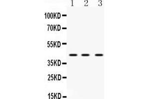 Western blot analysis of HnRNP F expression in rat liver extract ( Lane 1), mouse spleen extract ( Lane 2) and HELA whole cell lysates ( Lane 3). (HNRNPF 抗体  (N-Term))