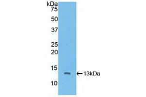 Detection of Recombinant CTNNbIP1, Human using Polyclonal Antibody to Catenin Beta Interacting Protein 1 (CTNNbIP1) (CTNNBIP1 抗体  (AA 1-81))