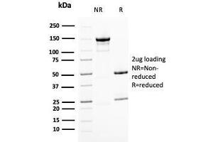 SDS-PAGE Analysis Purified BMI1 Mouse Monoclonal Antibody (BMI1/2823).