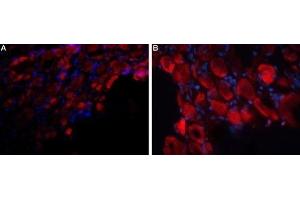 Expression of P2RX3 in rat DRG - Immunohistochemical staining of rat dorsal root ganglion (DRG) frozen sections using Anti-P2X3 Receptor (extracellular) Antibody (ABIN7043422, ABIN7045098 and ABIN7045099), followed by anti-rabbit-AlexaFluor-594 secondary antibody. (P2X3 Receptor (AA 65-79), (Extracellular) 抗体)