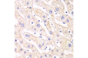 Immunohistochemistry of paraffin-embedded human liver injury using PSMF1 antibody at dilution of 1:100 (x40 lens). (PSMF1 抗体)