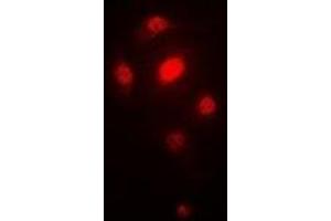 Immunofluorescent analysis of ORC6 staining in SW620 cells. (ORC6 抗体)