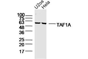 Lane 1: u2os lysates Lane 2: hela lysates probed with TAF1A Polyclonal Antibody, Unconjugated  at 1:300 dilution and 4˚C overnight incubation. (TAF1A 抗体  (AA 21-120))