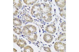 Immunohistochemistry of paraffin-embedded human stomach using CTSC antibody at dilution of 1:100 (x40 lens). (CTSC 抗体)