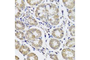 Immunohistochemistry of paraffin-embedded human stomach using CTSC antibody at dilution of 1:100 (x40 lens).