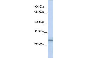 WB Suggested Anti-PSMB9 Antibody Titration:  0. (PSMB9 抗体  (C-Term))