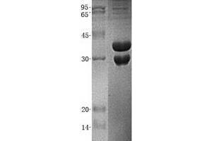 Western Blotting (WB) image for Ubiquitin-Conjugating Enzyme E2, J2 (UBE2J2) (Transcript Variant 2) protein (His tag) (ABIN2734855)