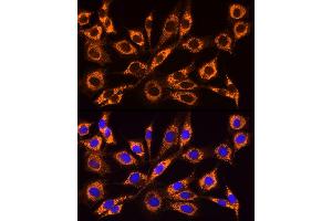 Immunofluorescence analysis of NIH/3T3 cells using  Rabbit pAb (ABIN6129864, ABIN6136458, ABIN6136459 and ABIN6222564) at dilution of 1:100 (40x lens). (ACSL4 抗体  (AA 1-280))