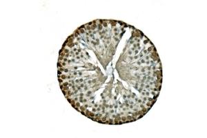 IHC analysis of LSM8 using anti-LSM8 antibody (ABIN7599579). (NAA38 抗体  (AA 1-96))