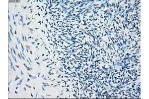 Immunohistochemistry (IHC) image for anti-Budding Uninhibited By Benzimidazoles 1 Homolog beta (Yeast) (BUB1B) antibody (ABIN1496996) (BUB1B 抗体)