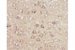 IHC-P: Amyloid beta antibody testing of mouse brain tissue (APP 抗体  (C-Term))
