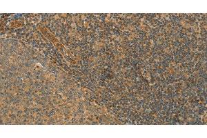 Immunohistochemistry of paraffin-embedded Human tonsil tissue using CPA2 Polyclonal Antibody at dilution 1:40 (Carboxypeptidase A2 抗体)